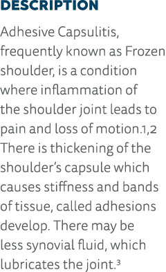 Description Adhesive Capsulitis, frequently known as Frozen shoulder, is a condition where inflammation of the should   