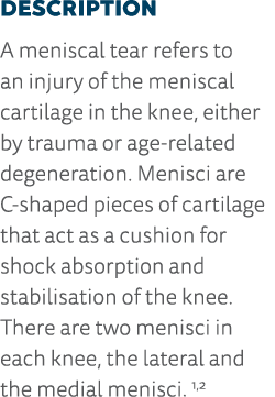 Description A meniscal tear refers to an injury of the meniscal cartilage in the knee, either by trauma or age-relate   